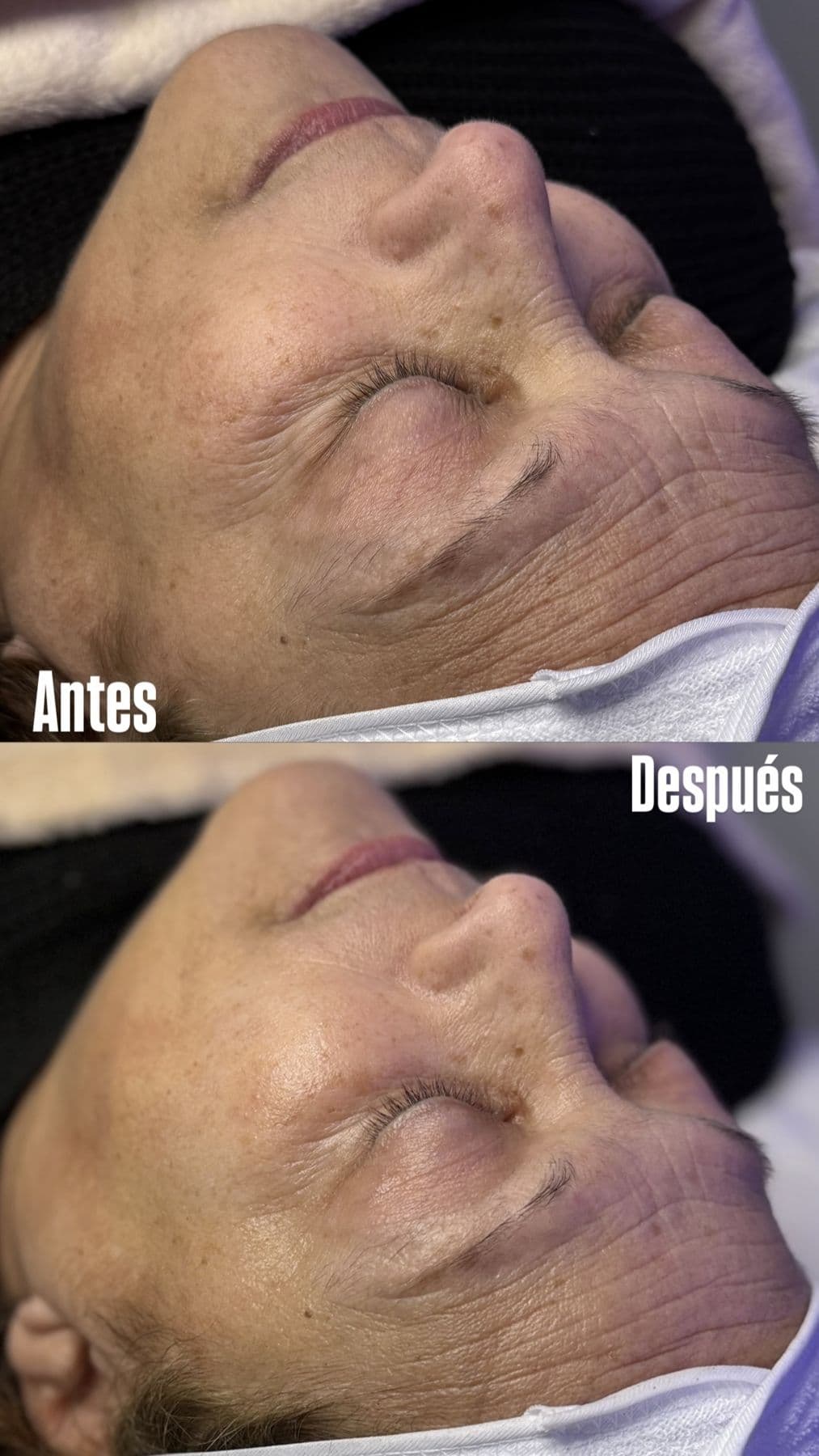 Tratamientos faciales, resultado 1