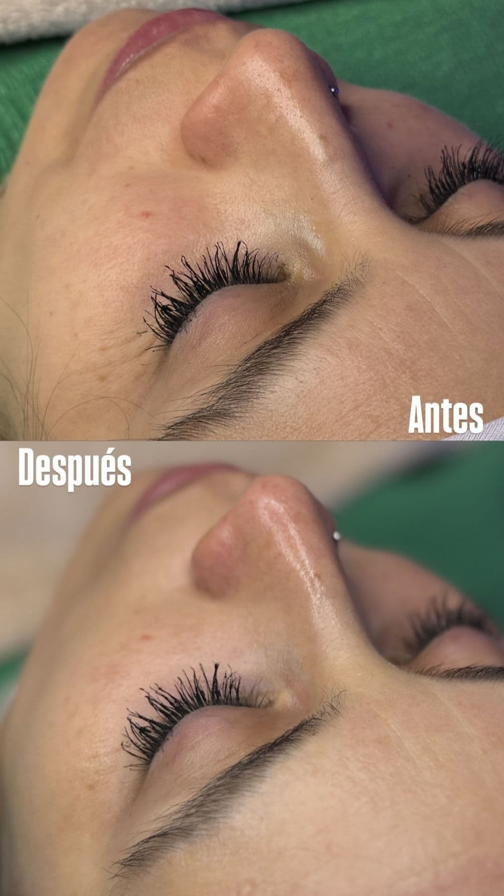 Tratamientos faciales, resultado 2