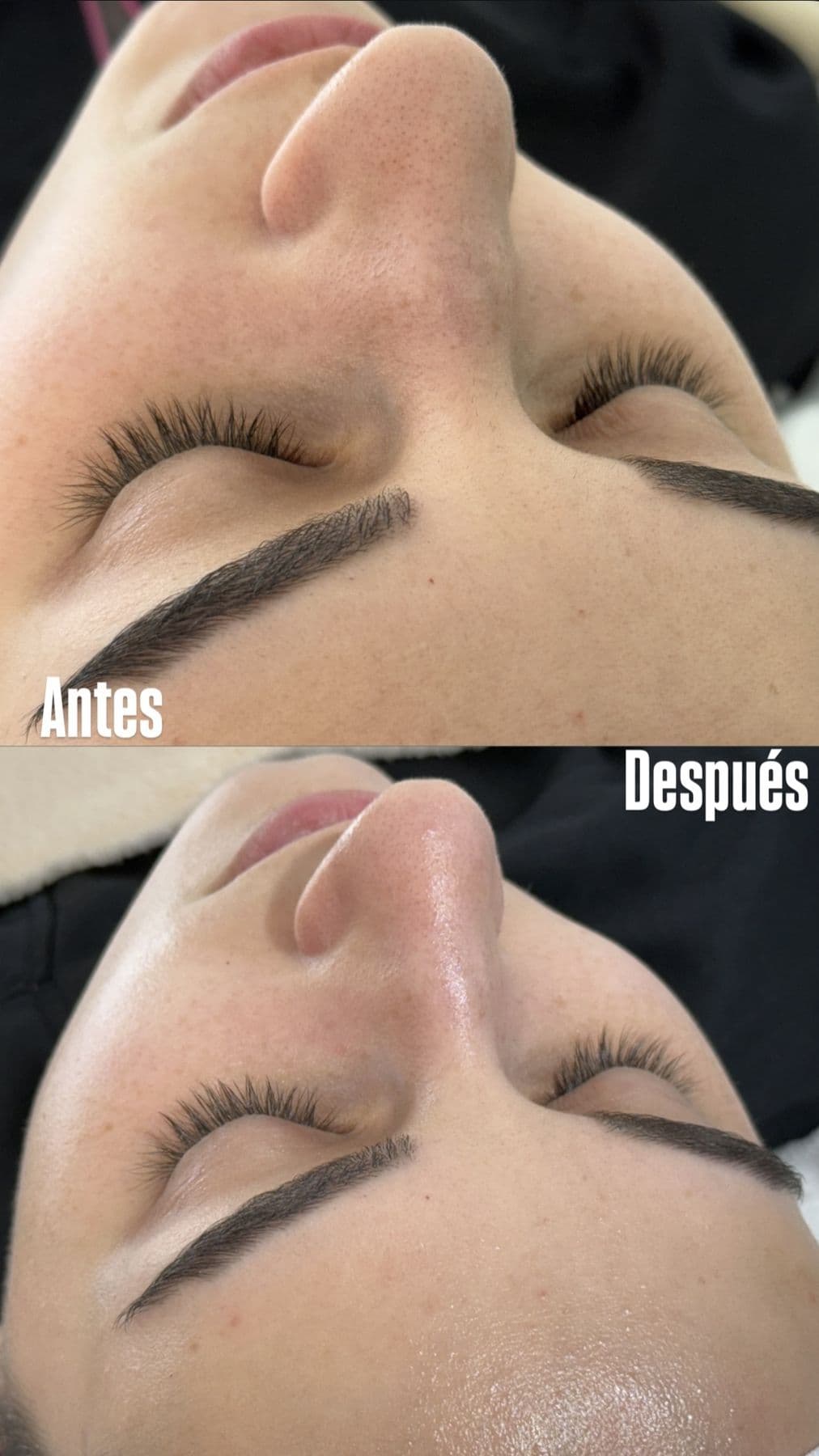 Tratamientos faciales, resultado 3