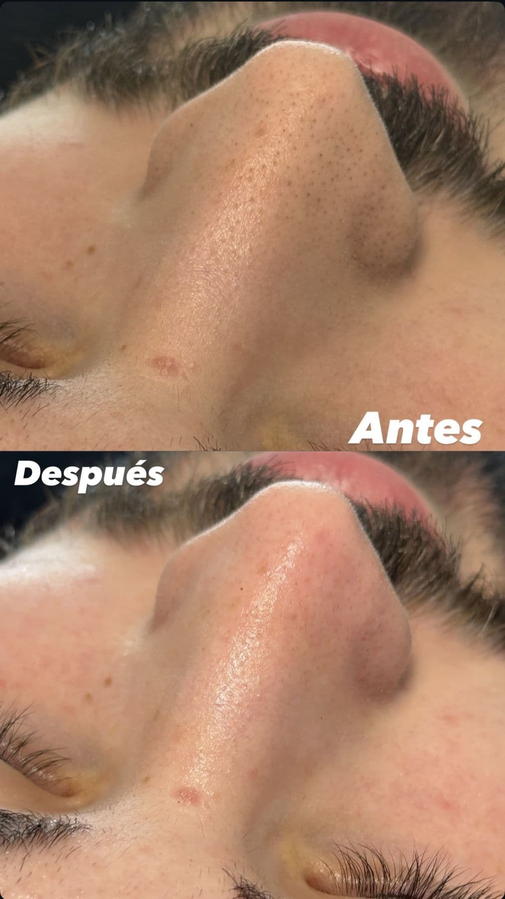 Tratamientos faciales, resultado 4